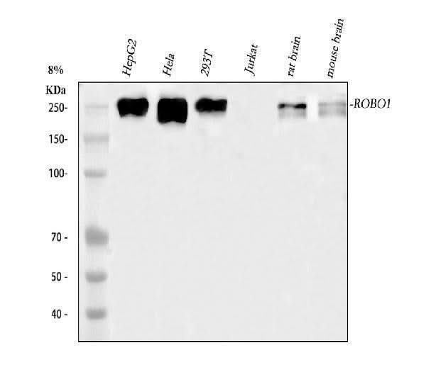 Anti-ROBO1 Antibody Picoband® Boster Bio