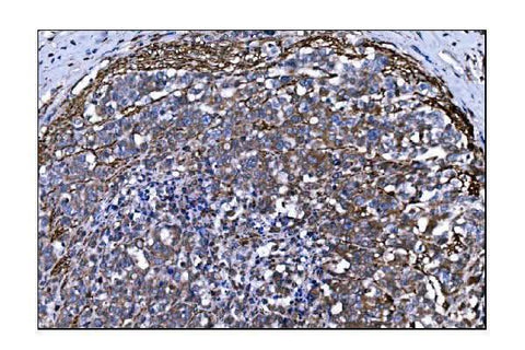 Anti-TLR8 Antibody Boster Bio