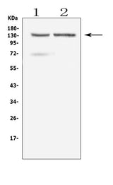 Anti-RTEL1 Antibody Picoband® Boster Bio