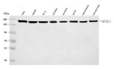 Anti-RTEL1 Antibody Picoband® Boster Bio