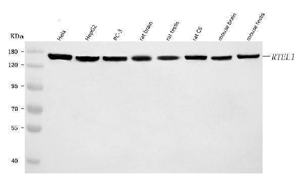Anti-RTEL1 Antibody Picoband® Boster Bio