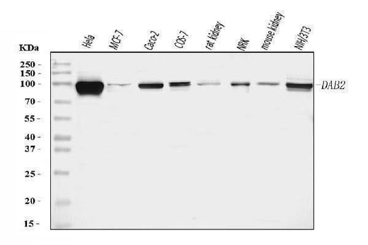 Anti-DAB2 Antibody Picoband® Boster Bio