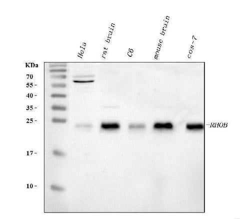 Anti-RHOB Antibody Picoband® Boster Bio