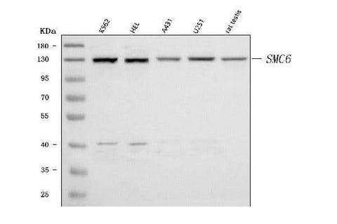Anti-SMC6 Antibody Picoband® Boster Bio