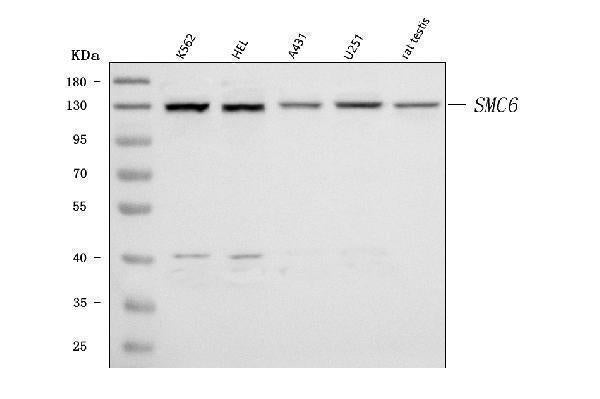 Anti-SMC6 Antibody Picoband® Boster Bio