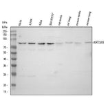 Anti-TEM8/ATR/ANTXR1 Antibody Picoband® Boster Bio