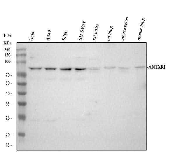 Anti-TEM8/ATR/ANTXR1 Antibody Picoband® Boster Bio