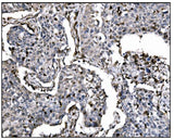 Anti-Fos B/FOSB Antibody Boster Bio