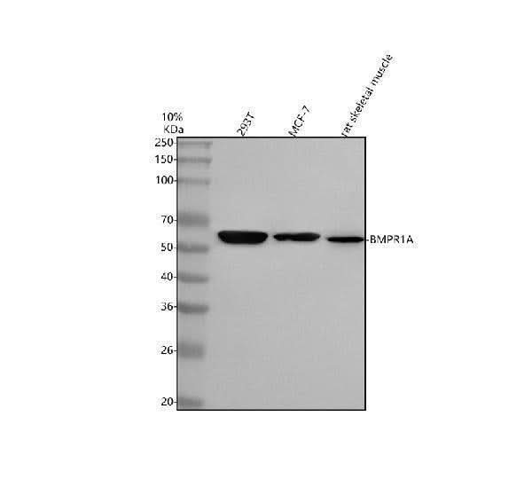 Anti-BMPR1A Antibody Picoband® Boster Bio