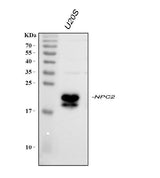 Anti-Niemann Pick C2/NPC2 Picoband® Antibody Boster Bio