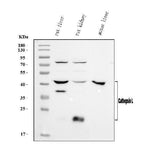 Anti-Cathepsin L/MEP/Ctsl Antibody Picoband® Boster Bio
