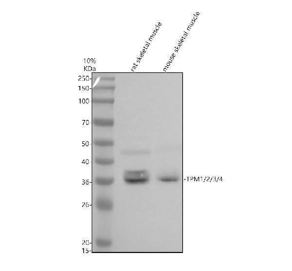 Anti-TPM1/2/3/4 Antibody Picoband® Boster Bio