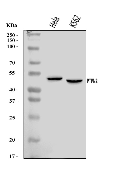Anti-TCPTP/PTPN2 Antibody Picoband® Boster Bio