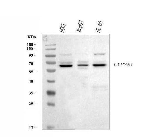 Anti-CYP7A1 Antibody Picoband® Boster Bio