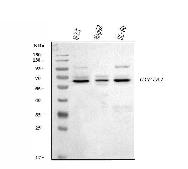 Anti-CYP7A1 Antibody Picoband® Boster Bio