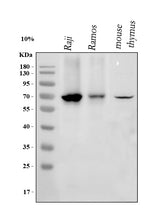 Anti-IKZF3 Antibody Picoband® Boster Bio