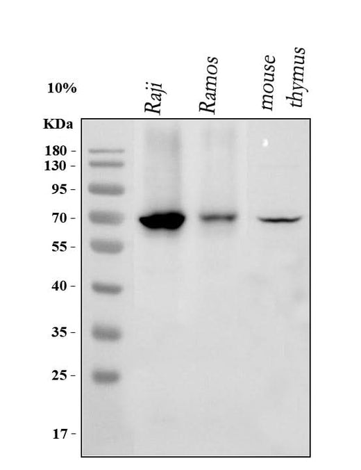 Anti-IKZF3 Antibody Picoband® Boster Bio