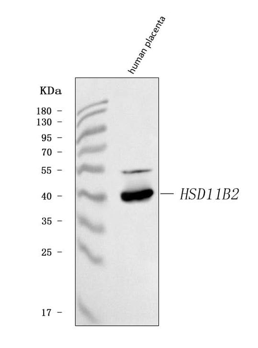 Anti-HSD11B2 Antibody Picoband® Boster Bio