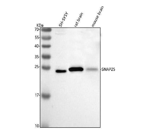 Anti-SNAP25 Antibody Picoband® Boster Bio