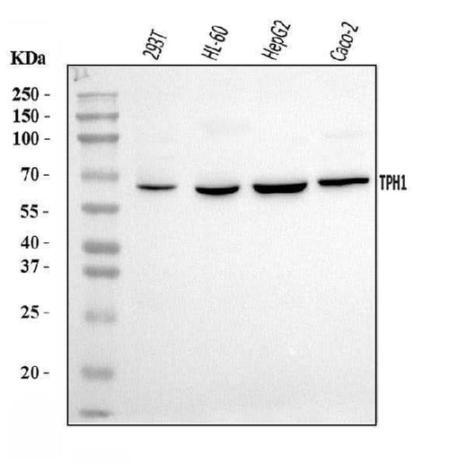 Anti-Tryptophan Hydroxylase/TPH1 Antibody Picoband® Boster Bio