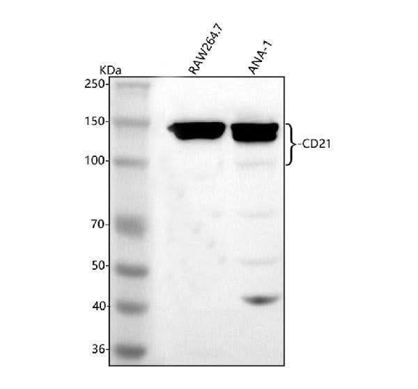 Anti-CD21/CR2 Antibody Picoband® Boster Bio