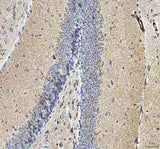 Anti-HCRT Antibody Boster Bio