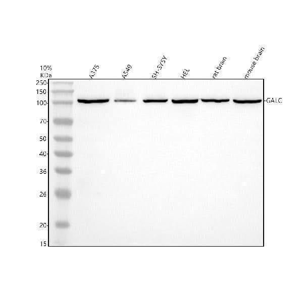 Anti-GALC Antibody Picoband® Boster Bio