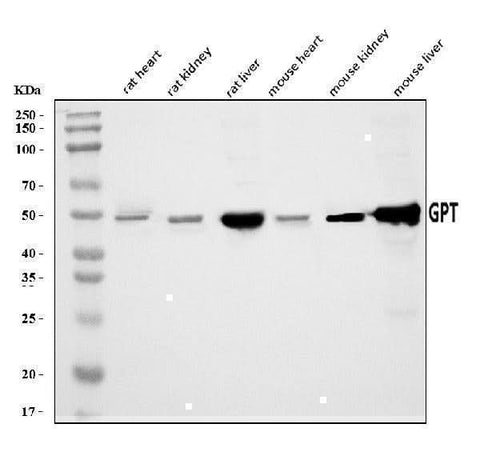 Anti-Alanine Transaminase/Gpt Antibody Picoband® Boster Bio