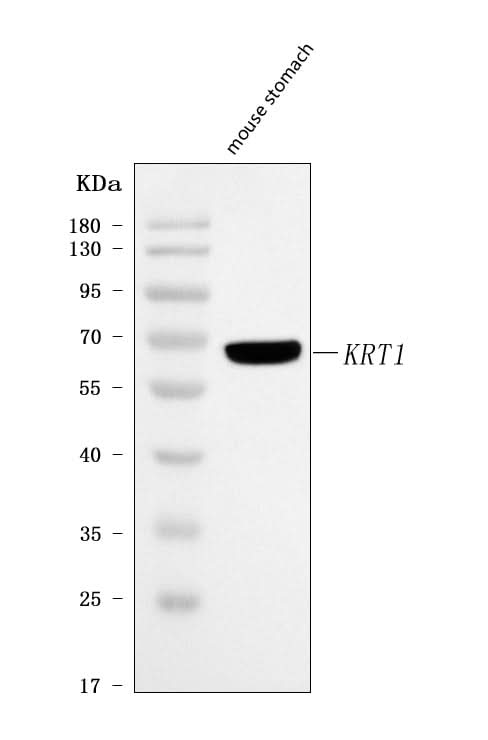 Anti-Cytokeratin 1/Krt1 Antibody Picoband® Boster Bio