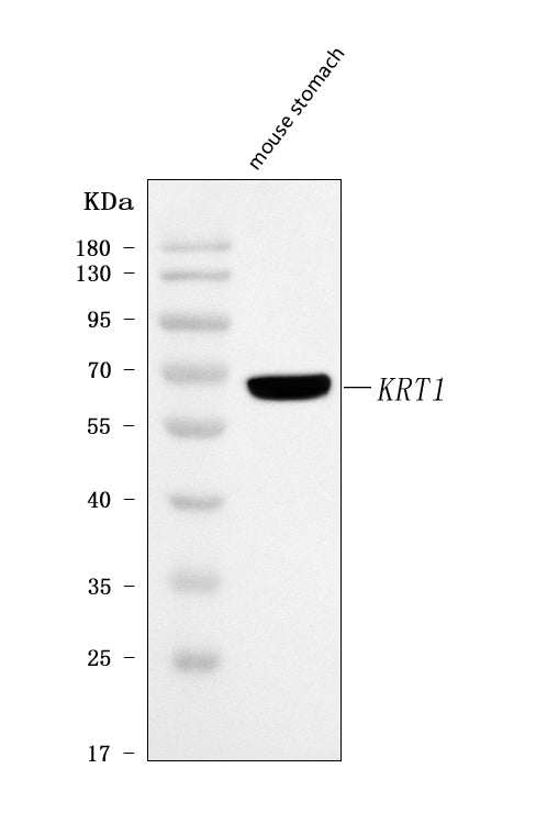 Anti-Cytokeratin 1/Krt1 Antibody Picoband® Boster Bio