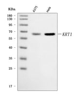 Anti-Cytokeratin 1/KRT1 Antibody Picoband® Boster Bio