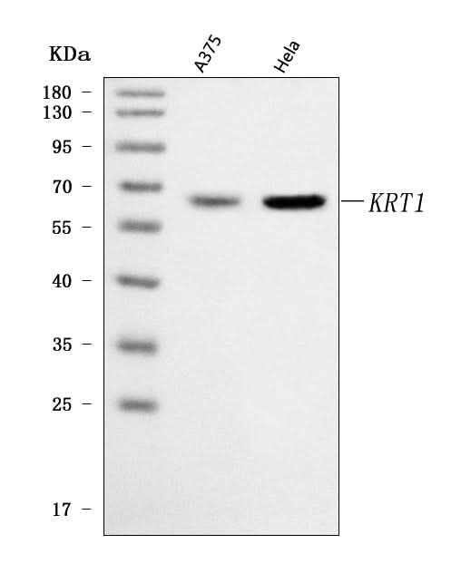 Anti-Cytokeratin 1/KRT1 Antibody Picoband® Boster Bio