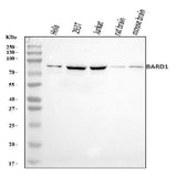 Anti-BARD1 Antibody Picoband® Boster Bio