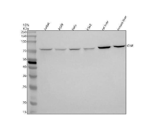 Anti-GNE Antibody Picoband® Boster Bio