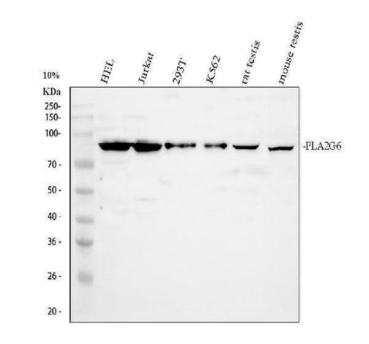 Anti-PLA2G6 Antibody Picoband® Boster Bio