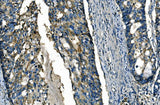 Anti-FGF4 Antibody Boster Bio
