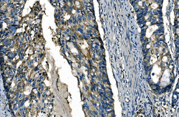 Anti-FGF4 Antibody Boster Bio