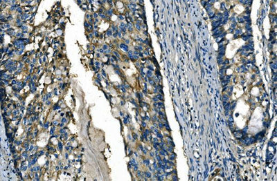 Anti-FGF4 Antibody Boster Bio