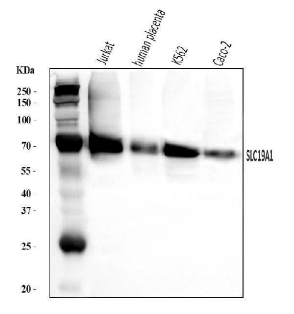 Anti-RFC/SLC19A1 Antibody Picoband® Boster Bio