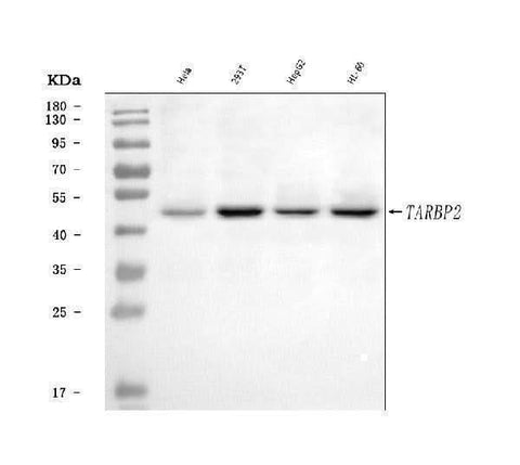Anti-TRBP/TARBP2 Antibody Picoband® Boster Bio