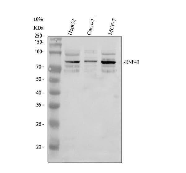 Anti-RNF43 Antibody Picoband® Boster Bio