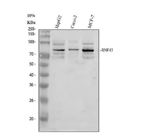 Anti-RNF43 Antibody Picoband® Boster Bio