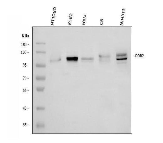 Anti-DDR2 Antibody Picoband® Boster Bio