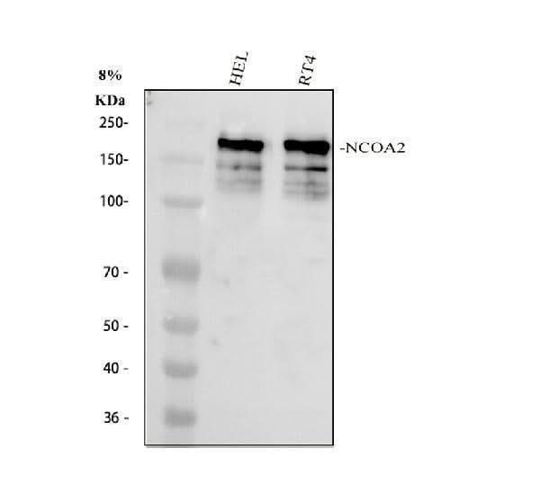 Anti-NCOA2 Antibody Picoband® Boster Bio