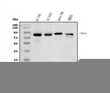 Anti-cGKI/PRKG1 Antibody Picoband® Boster Bio
