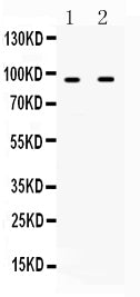 Anti-IFNGR1 Antibody Picoband® Boster Bio