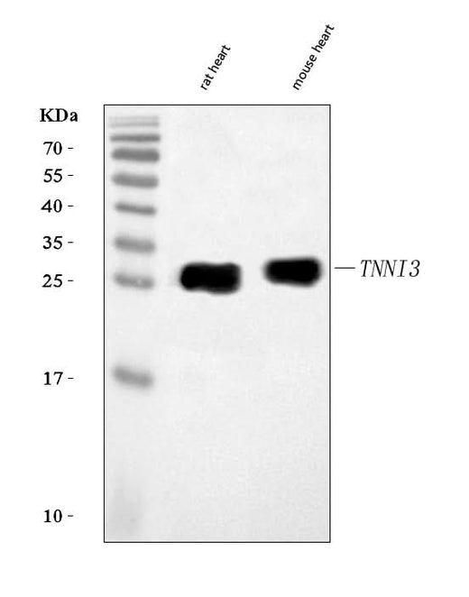 Anti-Cardiac Troponin I/TNNI3 Antibody Picoband® Boster Bio