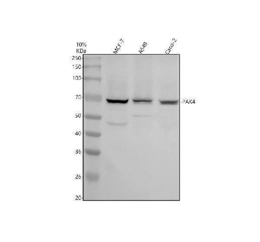 Anti-PAK4 Antibody Picoband® Boster Bio