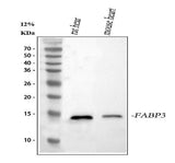 Anti-Cardiac FABP/Fabp3 Antibody Picoband® Boster Bio