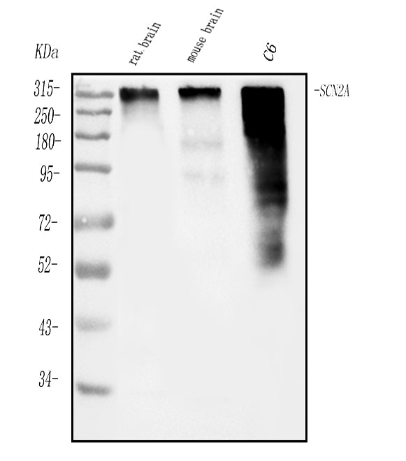 Anti-SCN2A Antibody Picoband® Boster Bio